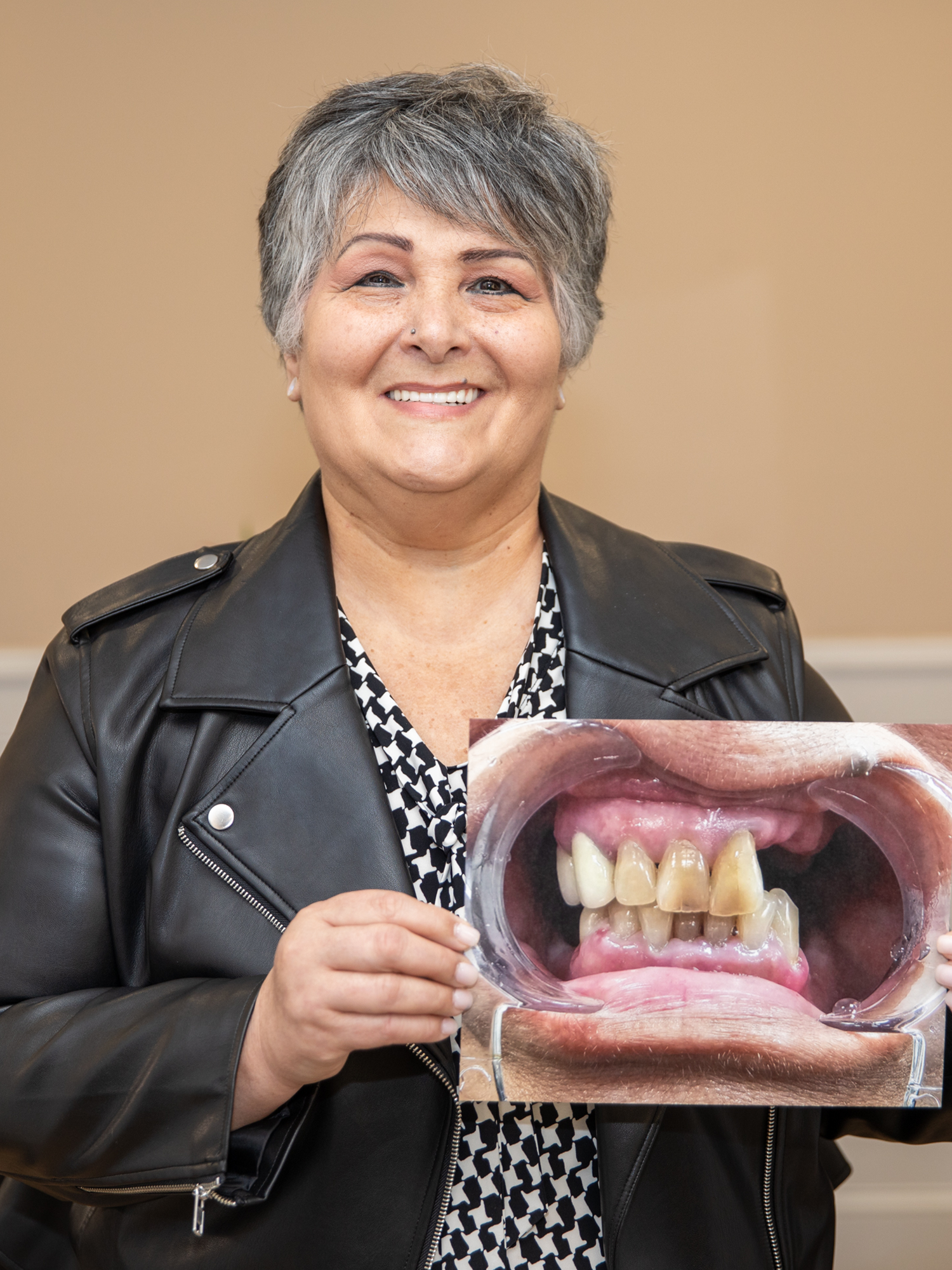 A gitlin dental group patient smiling and holding her before photo