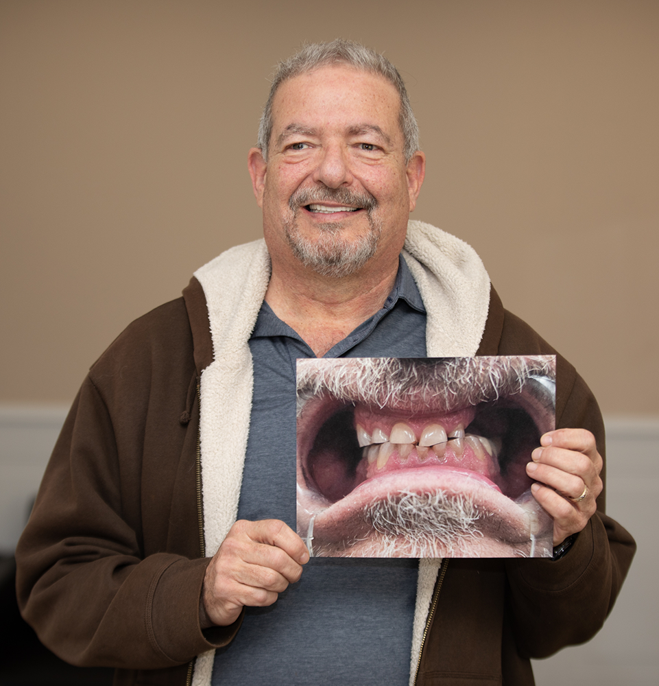 Gitlin dental patient smiling and holding his before photo